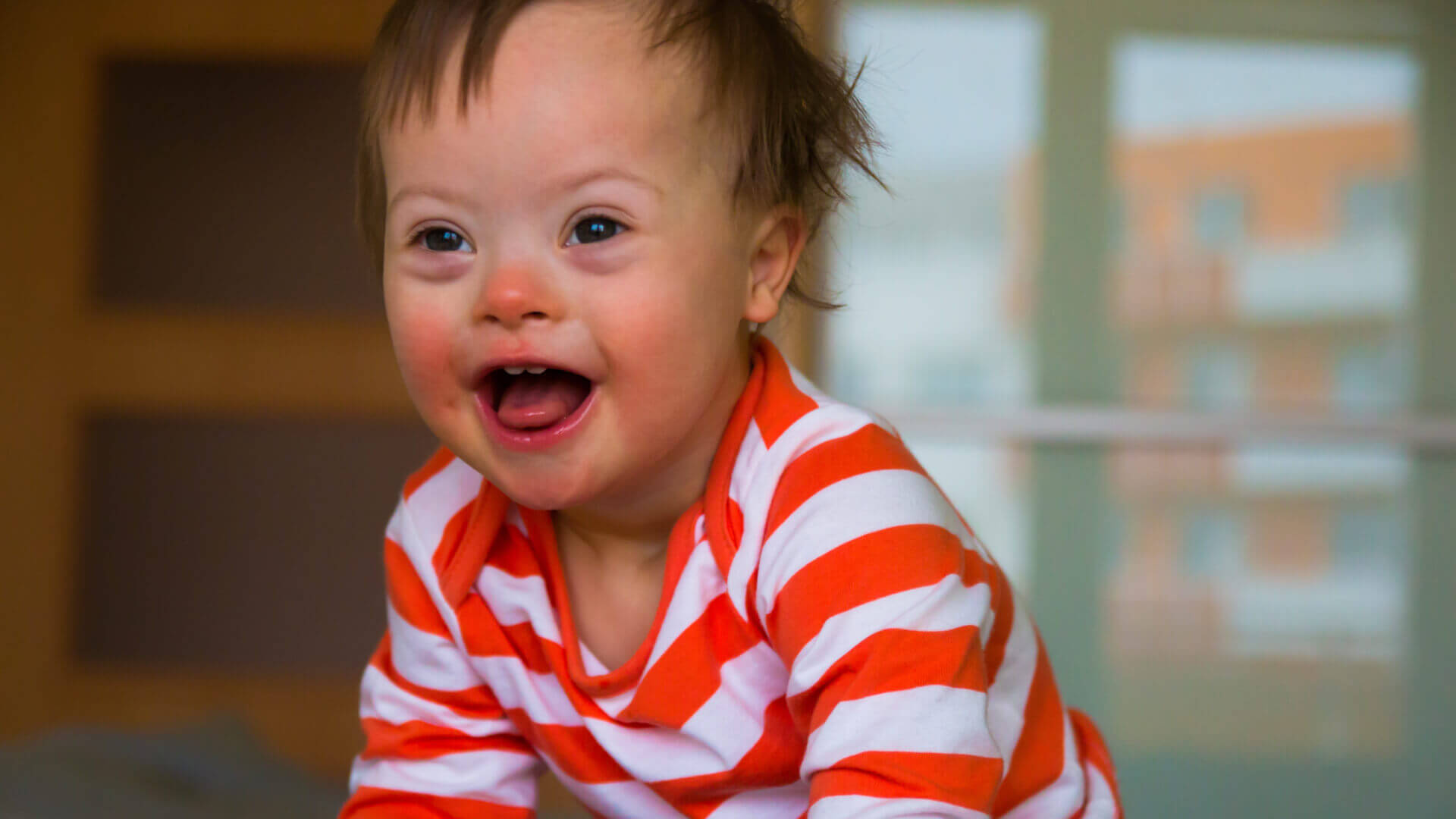 Child With Down Syndrome 1 